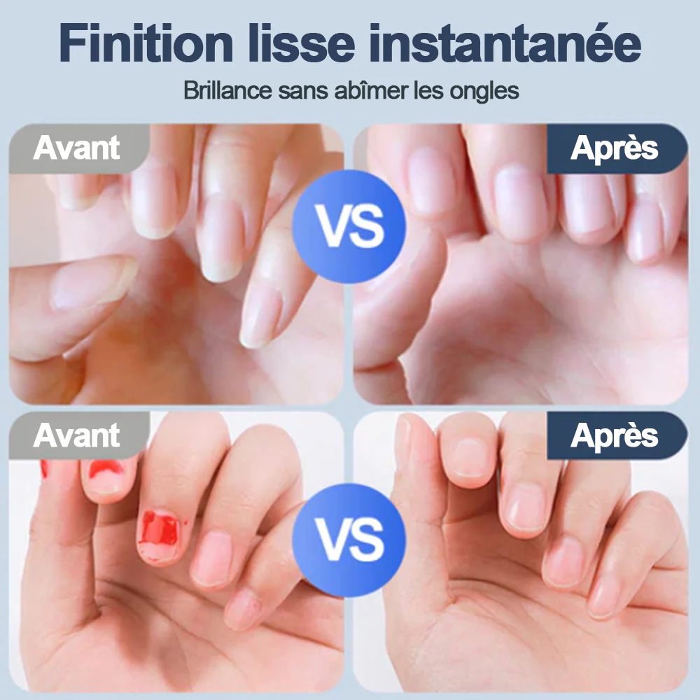 60off 💥 50% DE RÉDUCTION ! ✨ Ponceuse à Ongles Auto - 3 Vitesses Réglables, Silencieuse, LED Integrée pour Soin Précise 💅✨ -Remifa® (Copy) - Image 3